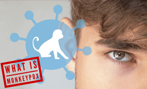 What Is Monkeypox – The No# 1 – In & Out Guide
