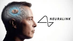Elon Musk’s Neuralink gets FDA approval for human trials